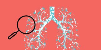 What Is Asthma? Symptoms, Causes, Diagnosis, Treatment, and Prevention
