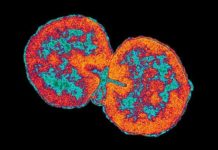 What Is Gonorrhea? Symptoms, Causes, Diagnosis, Treatment, and Prevention