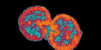 What Is Gonorrhea? Symptoms, Causes, Diagnosis, Treatment, and Prevention