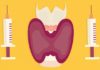 What Is Hyperthyroidism? Symptoms, Causes, Diagnosis, Treatment, and More