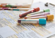 What Is Hypothyroidism? Symptoms, Causes, Diagnosis, Treatment, and Prevention