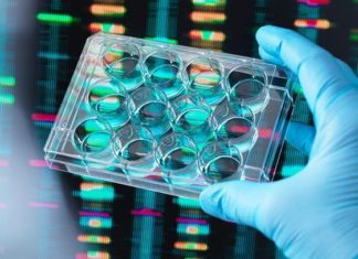 What Is Listeria Infection? Symptoms, Causes, Diagnosis, Treatment, and Prevention