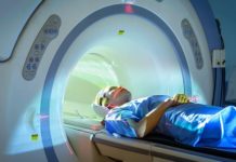 What Is Pancreatic Cancer? Symptoms, Causes, Diagnosis, Treatment, and Prevention