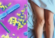 What Is Restless Legs Syndrome? Symptoms, Causes, Diagnosis, Treatment, and Prevention
