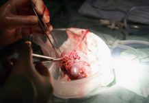 How the airline industry recovers from COVID-19 could determine who gets organ transplants