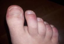 MIS-C is a rare but dangerous illness striking children weeks after they get COVID-19 – here's what we know about it