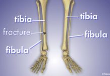 What’s the Difference Between the Fibula and Tibia?