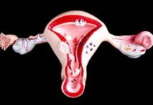 Adenomyosis and Fertility