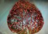 Scientists Grow Human Blood Vessels in Lab