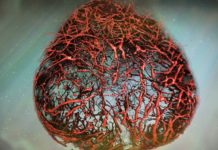 Scientists Grow Human Blood Vessels in Lab