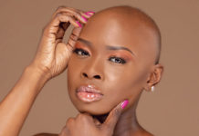 Living with Alopecia Areata