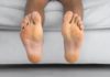 Tinea Pedis: 7 Remedies for Athlete’s Foot to Ease Symptoms