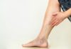 How to Get Rid of Varicose Veins: 9 Home Remedies That Work