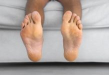 Tinea Pedis: 7 Remedies for Athlete’s Foot to Ease Symptoms