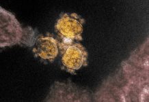 How to stay safe with a fast-spreading new coronavirus variant on the loose