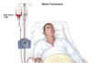 What Is a Blood Transfusion?
