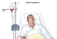 What Is a Blood Transfusion?