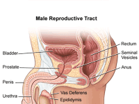 What Is a Prostatectomy?