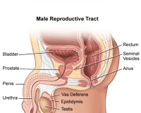 What Is a Prostatectomy?