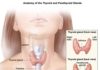 What Is a Thyroidectomy?
