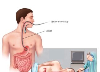 What Is an Endoscopy?