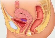 What Is an Ovarian Cyst? Symptoms, Causes, Diagnosis, Treatment, and Prevention