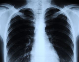 what-is-an-x-ray