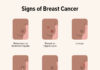 What Is Breast Pain? Symptoms, Causes, Diagnosis, Treatment, and Prevention