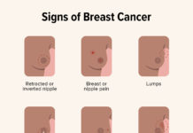 What Is Breast Pain? Symptoms, Causes, Diagnosis, Treatment, and Prevention