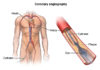 What Is Cardiac Catheterization?