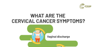 What Is Cervical Cancer? Symptoms, Causes, Diagnosis, Treatment, and Prevention