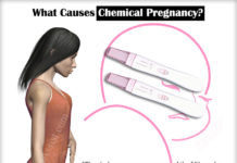 What Is Chemical Pregnancy? Symptoms, Causes, Diagnosis, and Treatment