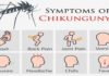 What Is Chikungunya? Symptoms, Causes, Diagnosis, Treatment, and Prevention