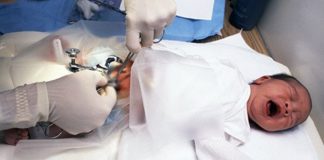What Is Circumcision?
