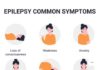 What Is Epilepsy? Symptoms, Causes, Diagnosis, Treatment, and Prevention