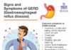 What Is GERD? Symptoms, Causes, Diagnosis, Treatment, and Prevention