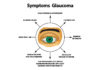 What Is Glaucoma? Symptoms, Causes, Diagnosis, Treatment, and Prevention