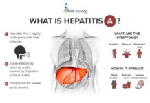 What Is Hepatitis A? Symptoms, Causes, Diagnosis, Treatment, and Prevention