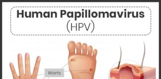 What Is HPV? Symptoms, Causes, Diagnosis, Treatment, and Prevention