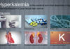 What Is Hyperkalemia? Symptoms, Causes, Diagnosis, Treatment, and Prevention