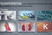 What Is Hyperkalemia? Symptoms, Causes, Diagnosis, Treatment, and Prevention