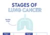 What Is Lung Cancer? Symptoms, Causes, Diagnosis, Treatment, and Prevention