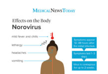 What Is Norovirus? Symptoms, Causes, Diagnosis, Treatment, and Prevention