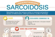 What Is Sarcoidosis? Symptoms, Causes, Diagnosis, Treatment, and Prevention