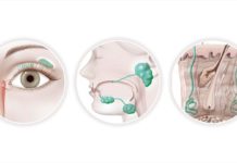 What Is Sjögren's Syndrome? Symptoms, Causes, Diagnosis, Treatment, and Prevention