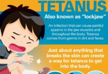 What Is Tetanus? Symptoms, Causes, Diagnosis, Treatment, and Prevention