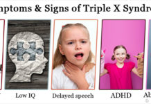 What Is Triple X Syndrome? Symptoms, Causes, Diagnosis, Treatment, and Prevention