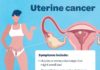 What Is Uterine Cancer? Symptoms, Causes, Diagnosis, Treatment, and Prevention