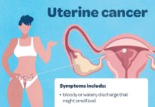 What Is Uterine Cancer? Symptoms, Causes, Diagnosis, Treatment, and Prevention