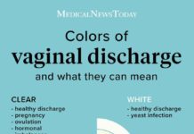 What Is Vaginal Discharge? Symptoms, Causes, Diagnosis, and Treatment